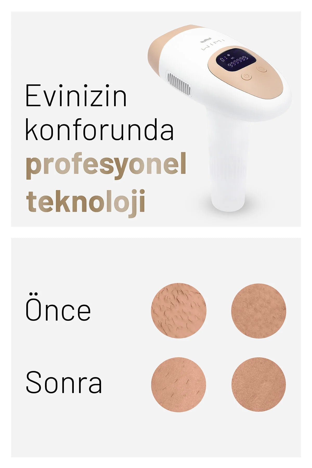 Wİ-Mİ IPL Buz Lazer Epilasyon Aleti Tüy Alma Cihazı