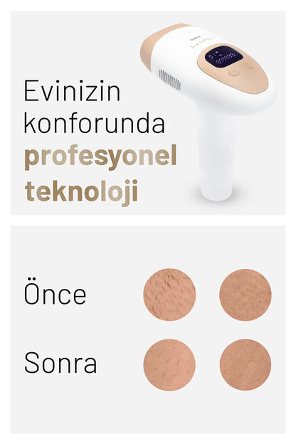 Wİ-Mİ IPL Buz Lazer Epilasyon Aleti Tüy Alma Cihazı